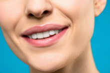 Dents